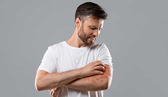 Skin Doctor Talks About Eczema