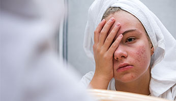Taking the Help of a Skin Doctor- When is it Necessary?