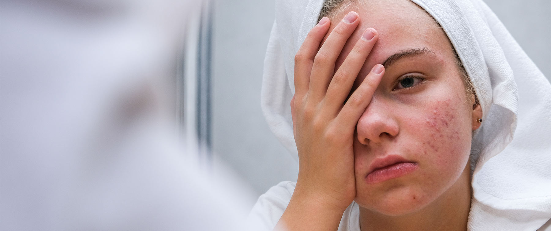 Taking the Help of a Skin Doctor- When is it Necessary?