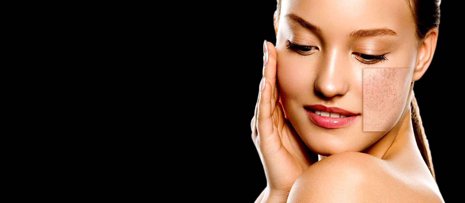 Best Pigmentation Treatment in Bangalore, JP Nagar - Dr. Rajdeep Mysore