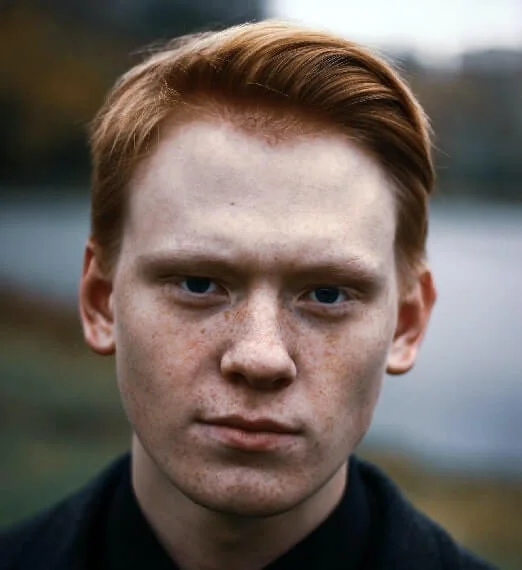 Pigmentation Treatment In Bangalore