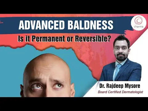 What causes Advanced Baldness? What are the treatment options
