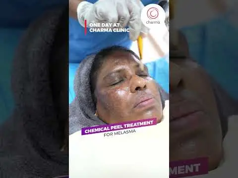 Discover a Flawless Radiant Skin with Charma Clinic's Advanced Skincare Solutions