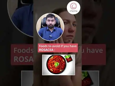 Foods that worsen acne, rosacea and cause premature ageing - Dr. Rajdeep Mysore | Charma Clinic