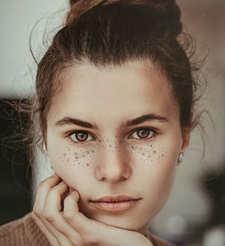 Pigmentation
