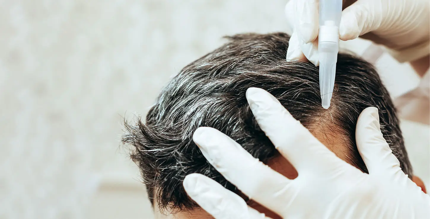 Hair Transplant